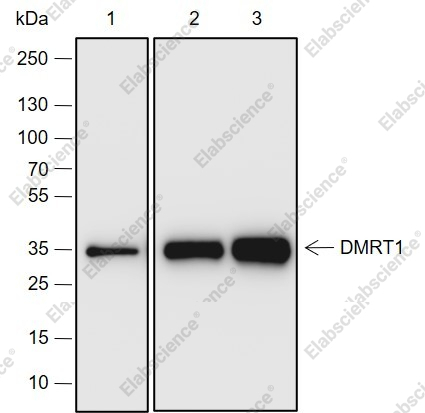 Recombinant DMRT1 Monoclonal Antibody - 1