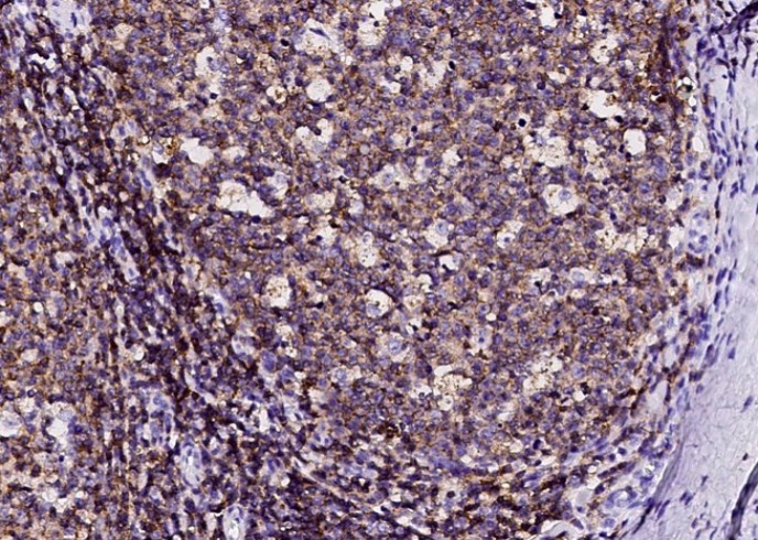 Recombinant Ly108/SLAMF6 Monoclonal Antibody - small - 1
