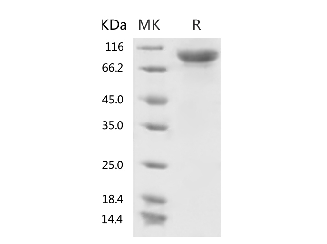 Immobilized Recombinant Human ACE2 Protein (mFc Tag)(Cat: PKSR030509) at 2 ug/mL (100 uL/well) can bind Recombinant 2019-nCoV S1 Protein, Biotinylated (His Tag) (Cat: PKSR030514), the EC50 of Recombinant 2019-nCoV S1 Protein, Biotinylated (His Tag) (Cat: PKSR030514) is 300-700 ng/mL.