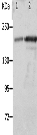 Western Blot analysis of Mouse spleen and kidney tissue using NPHS1 Polyclonal Antibody at dilution of 1:800