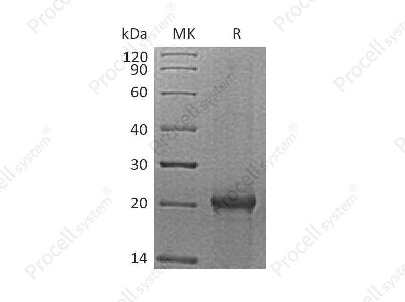 IL-6/IFN-&beta;2/BSF-2/HPGF/HSF, Mouse, Recombinant