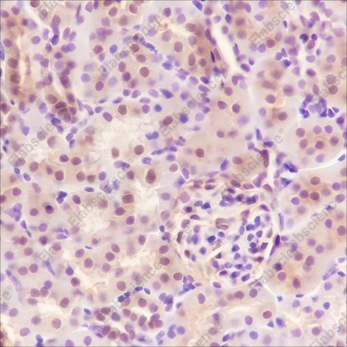Recombinant SBDS Monoclonal Antibody - 5