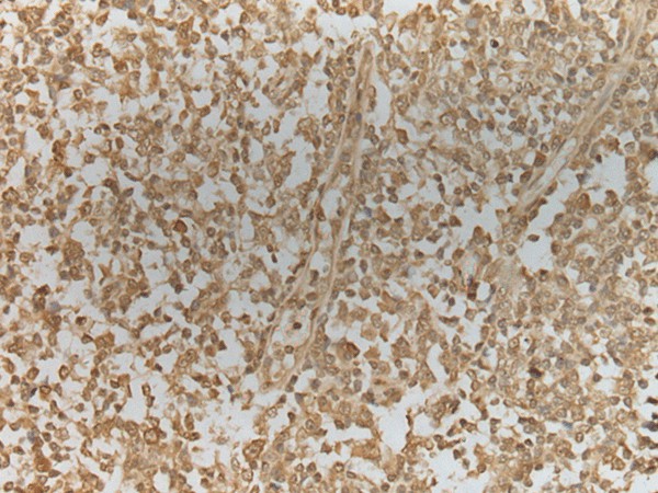 Immunohistochemistry of paraffin-embedded Human tonsil tissue  using ZNF8 Polyclonal Antibody at dilution of 1:40(?200)