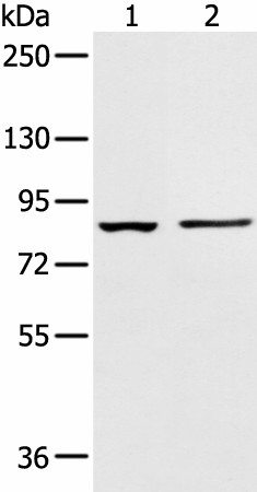 Western blot analysis of 293T cell and Human left kidney tissue  using AAK1 Polyclonal Antibody at dilution of 1:400