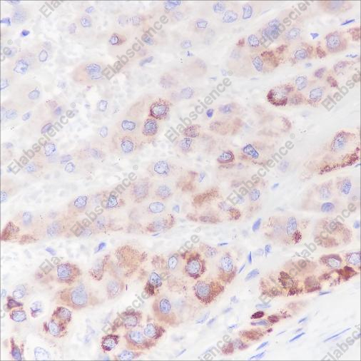 Recombinant PDK1 Monoclonal Antibody - 3