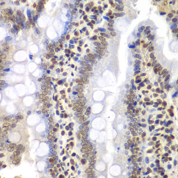 Immunohistochemistry of paraffin-embedded rat intestine using PSMC3 Polyclonal Antibody at dilution of 1:200 (40x lens).Perform microwave antigen retrieval with 10 mM PBS buffer pH 7.2 before commencing with IHC staining protocol.