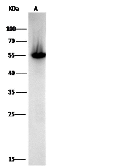 ALDH1/ALDH1A1/ALDC Monoclonal Antibody - small - 1
