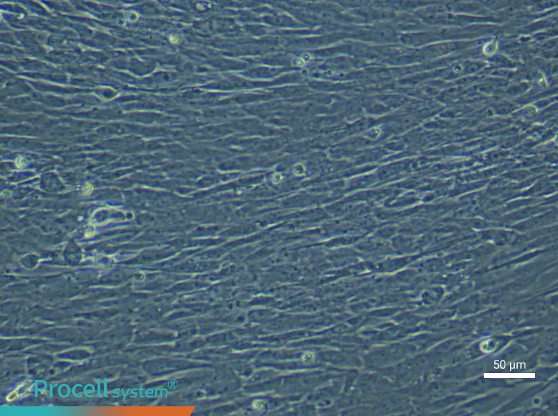 Human Ovarian Cancer Fibroblast (Primary cell immortalization) Complete Medium - 4