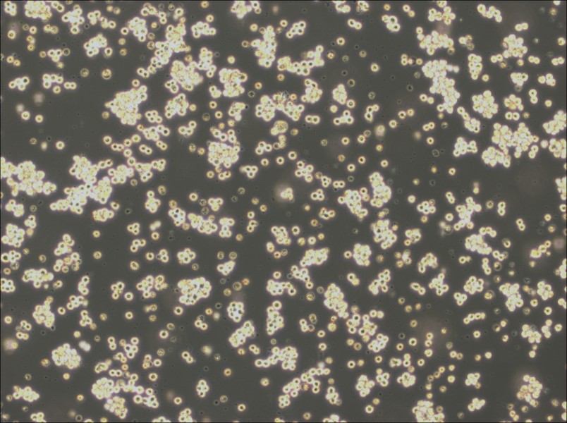 Akata Cell Complete Medium - 2