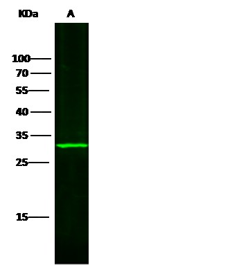 SULT1A1 Monoclonal Antibody - small - 2
