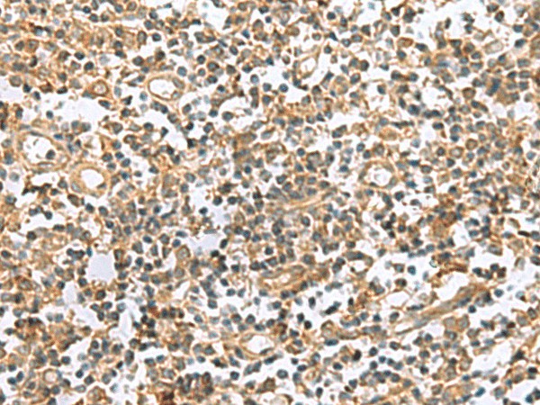 Immunohistochemistry of paraffin-embedded Human tonsil tissue  using HHIPL2 Polyclonal Antibody at dilution of 1:50(?200)