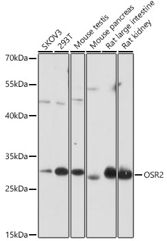 Western blot analysis of extracts of various cell lines using OSR2 Polyclonal Antibody at 1:1000 dilution.