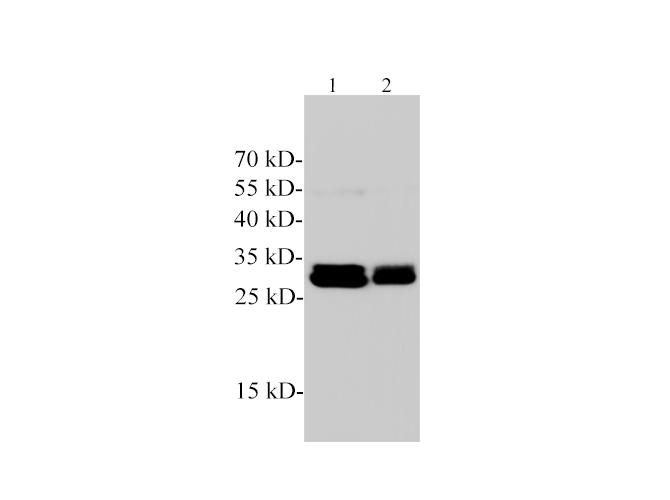 Western blotting with anti-Dnase I polyclonal antibody at dilution of 1:1000. Lane 1:MCF-7 cell lysate, Lane 2:Hela cell lysate.