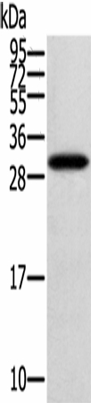 Western Blot analysis of Human fetal brain tissue using STARD5 Polyclonal Antibody at dilution of 1:400