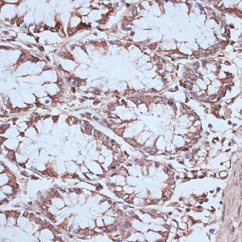 Immunohistochemistry of paraffin-embedded Human colon using NFE2L1 Polyclonal Antibody at dilution of 1:100 (40x lens).