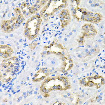 Immunohistochemistry of paraffin-embedded Rat kidney using CDCA8 Polyclonal Antibody at dilution of 1:100 (40x lens).