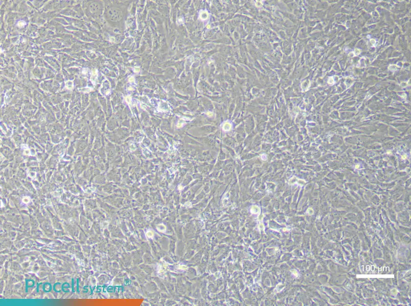 Mouse Dermal Fibroblasts (Primary cell immortalization)Mouse Dermal Fibroblasts (Primary cell immortalization) - 2