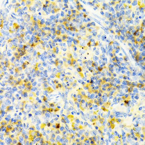 Immunohistochemistry of paraffin-embedded Rat spleen using PAK1 Polyclonal Antibody at dilution of  1:100 (40x lens).