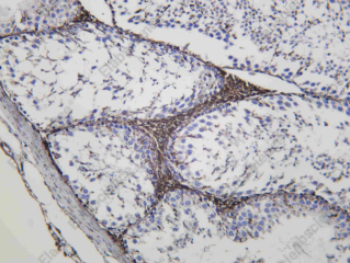 Recombinant TSPO Monoclonal Antibody - 3