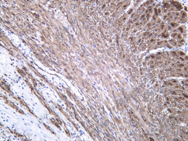 Recombinant Myosin Heavy Chain, Smooth Muscle (SMMHC) Monoclonal Antibody - 1