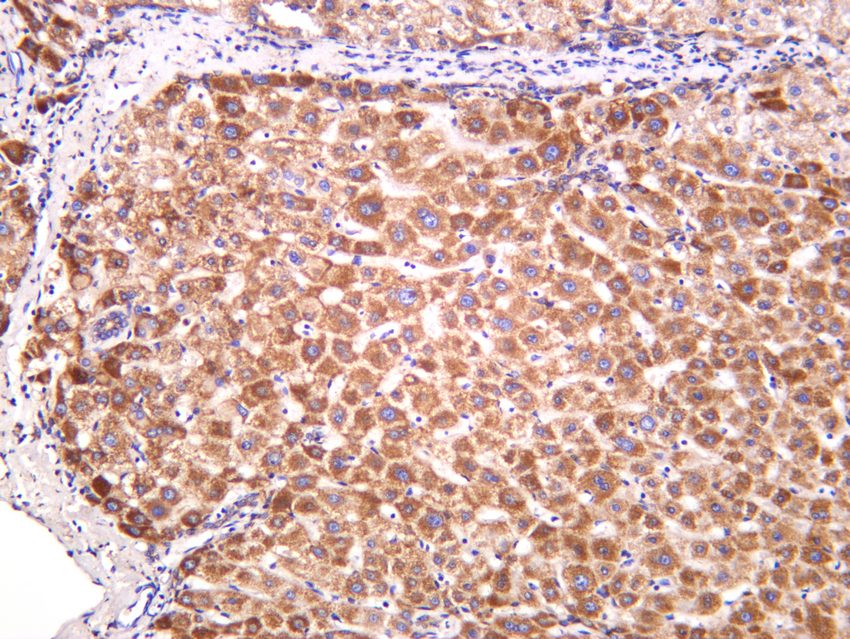 Recombinant IFNGR1/CD119/IFN-gamma-R1 Monoclonal Antibody - small - 5