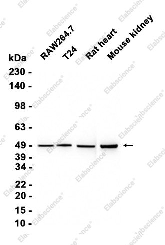 Recombinant beta IV Tubulin Monoclonal Antibody - 1