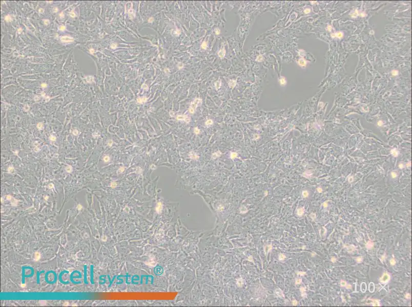 TTA1 Cell Complete Medium - 2
