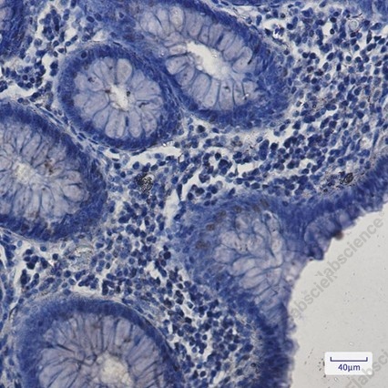 Recombinant SP1 Monoclonal Antibody - 3