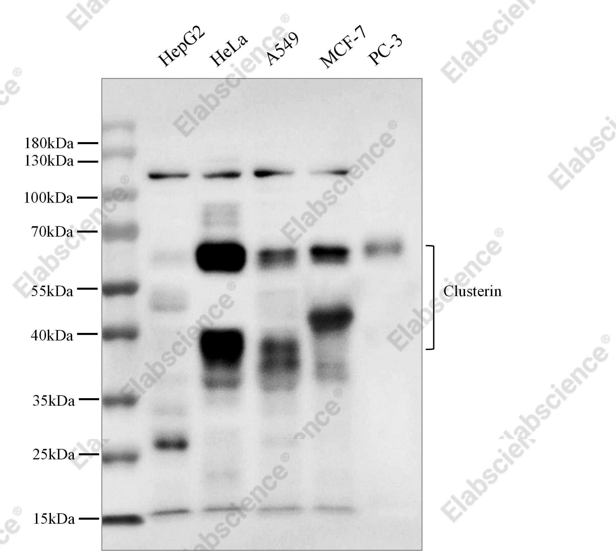 Recombinant Clusterin/Apolipoprotein J/Apo-J Monoclonal Antibody - 3
