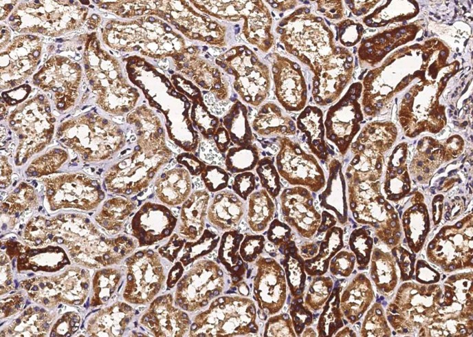 Recombinant Thioredoxin-2/TXN2 Monoclonal Antibody - small - 2