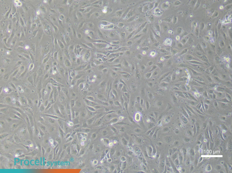 Human Umbilical Vein Endothelial (Primary cell immortalization) Cell Complete Medium - 2