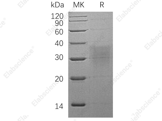 Recombinant Human BMPR2 Protein (His Tag) - 1