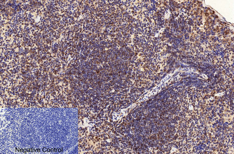 Immunohistochemistry of paraffin-embedded Mouse spleen tissue using CD2 Monoclonal Antibody at dilution of 1:200.