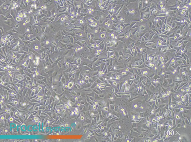 MKN1 Cell Complete Medium - 1