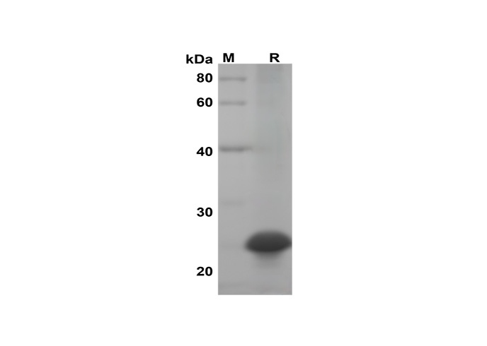Recombinant Mouse IL-17A Protein(Sumo Tag)-产品推荐-1