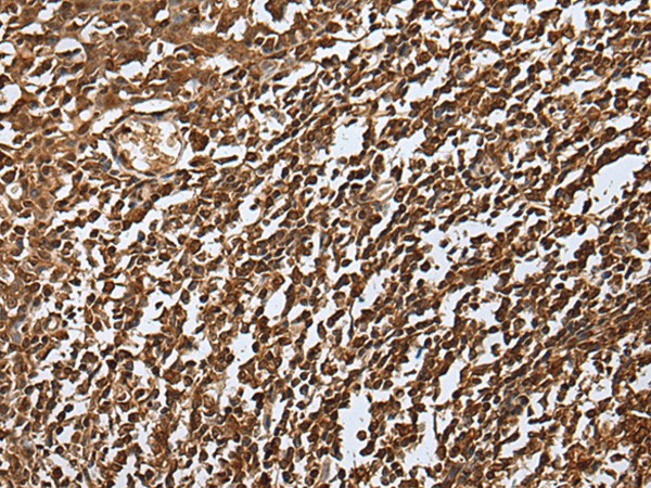 Immunohistochemistry of paraffin-embedded Human tonsil tissue  using UBE2V1 Polyclonal Antibody at dilution of 1:30(?200)