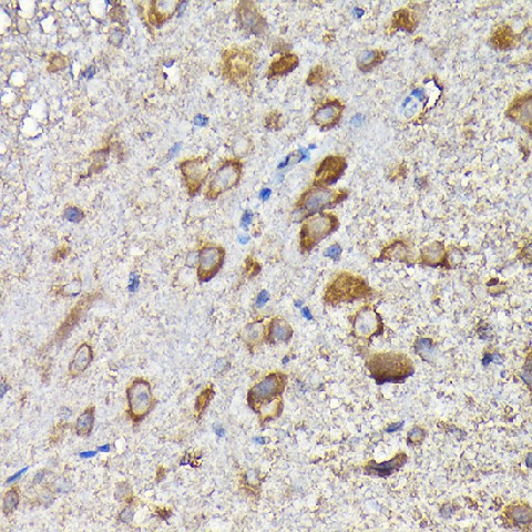 Immunohistochemistry of paraffin-embedded mouse spinal cord using MTHFD1L Polyclonal antibody at dilution of 1:200 (40x lens).Perform high pressure antigen retrieval with 10 mM citrate buffer pH 6.0 before commencing with IHC staining protocol.
