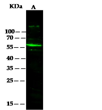 Recombinant SerpinF2 Monoclonal Antibody-searchlist-1
