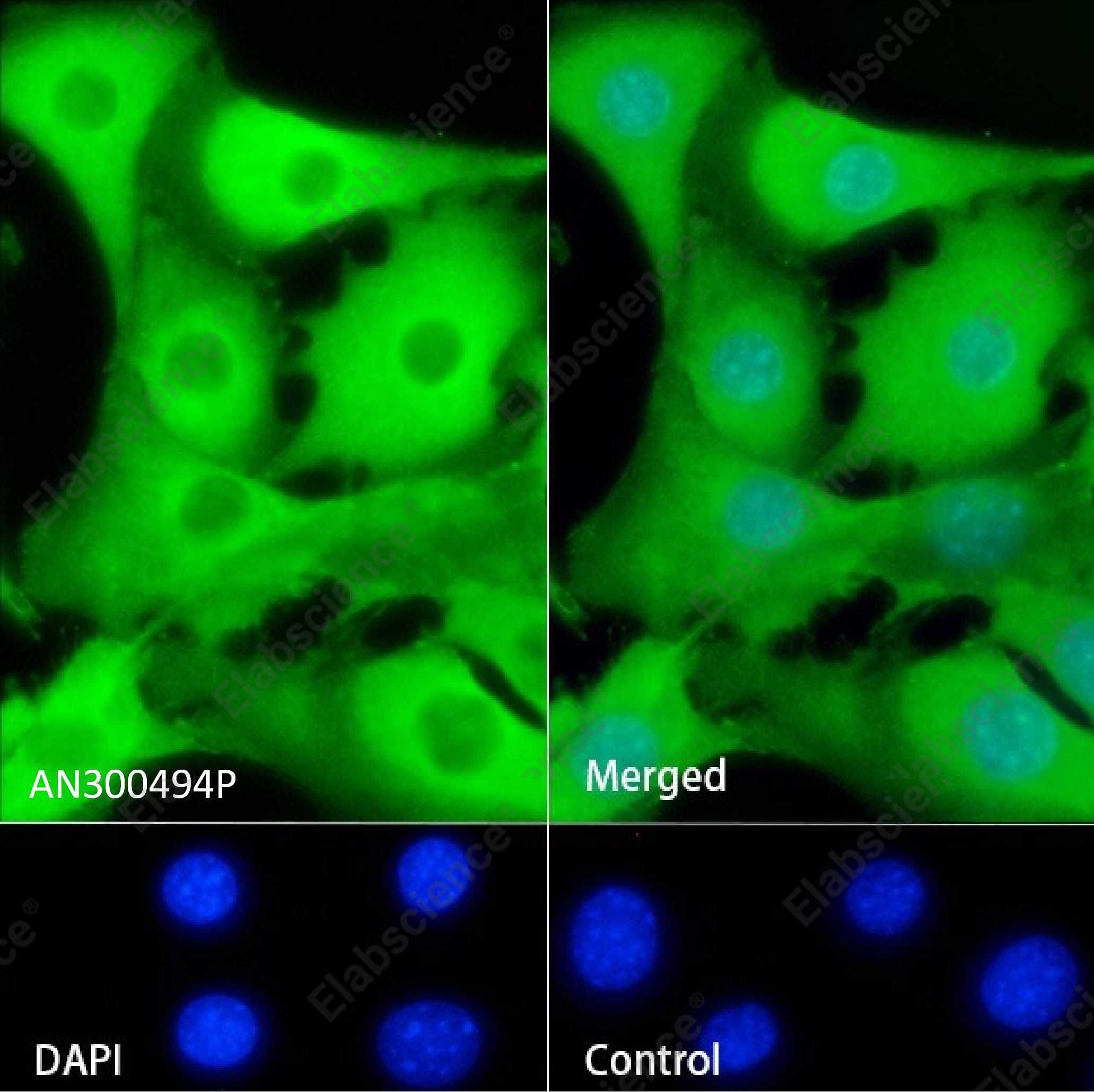 Recombinant S100A6/Calcyclin/CACY Monoclonal Antibody - 2