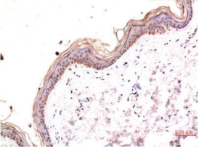 Immunohistochemistry of paraffin-embedded Human skin tissue with Phospho-MLKL (Ser358) Monoclonal Antibody at dilution of 1:200