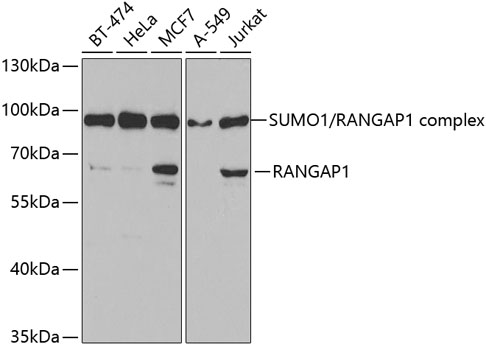 Western blot analysis of extracts of various cell lines using RanGAP1 Polyclonal Antibody at 1:1000 dilution.