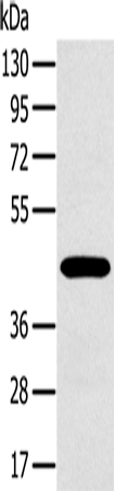 Western Blot analysis of A375 cell using MAGEA10 Polyclonal Antibody at dilution of 1:400