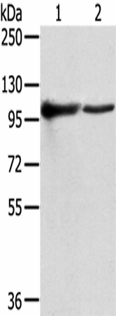 Western Blot analysis of K562 and A431 cells using TPX2 Polyclonal Antibody at dilution of 1/800