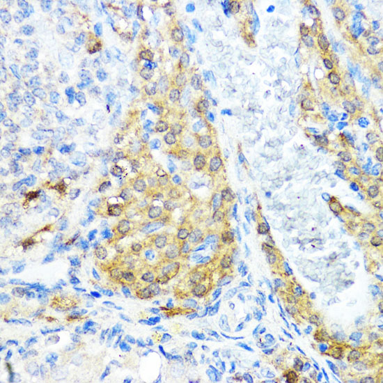 Immunohistochemistry of paraffin-embedded Rat ovary using NOD1 Polyclonal Antibody at dilution of 1:100 (40x lens).