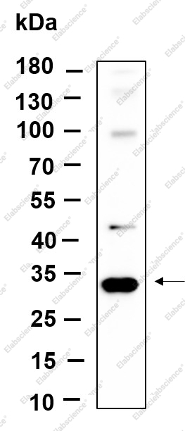 Recombinant Snail Monoclonal Antibody - 1