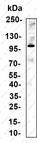 Recombinant ABCG1 Monoclonal Antibody - 1