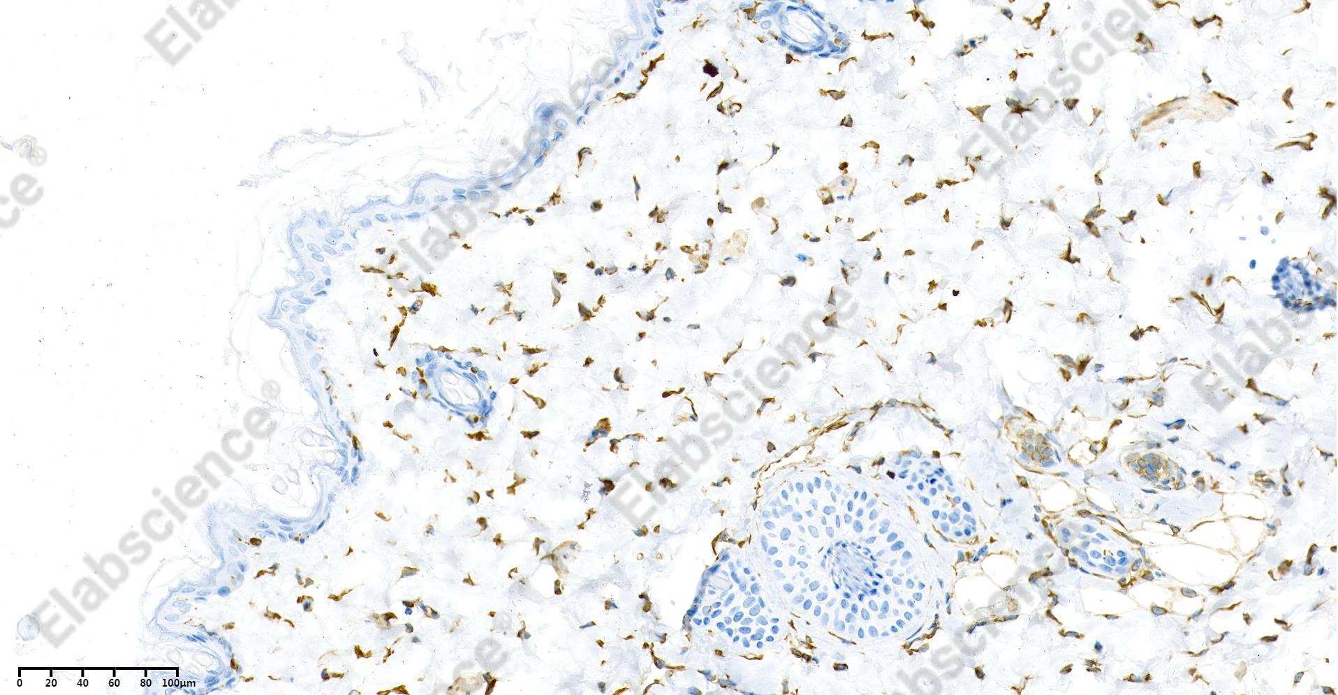 Recombinant Vimentin Monoclonal Antibody - 6