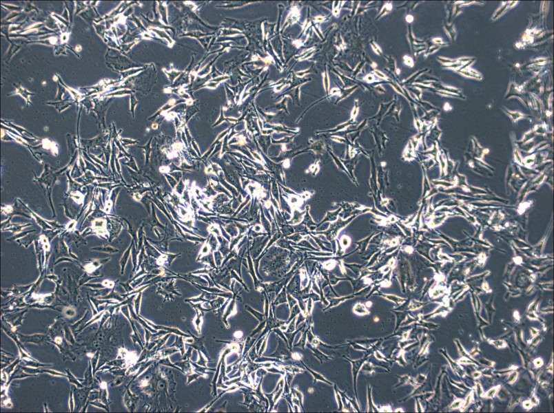 SK-MEL-2 Cell Complete Medium - small - 4