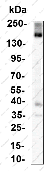 Recombinant ADAR1 Monoclonal Antibody - 1
