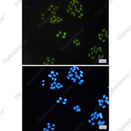 Recombinant TAF15 Monoclonal Antibody - 3
